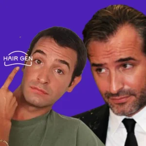 Jean Dujardin avant et après : évolution capillaire comparée, avec logo Hair Gen en fond.