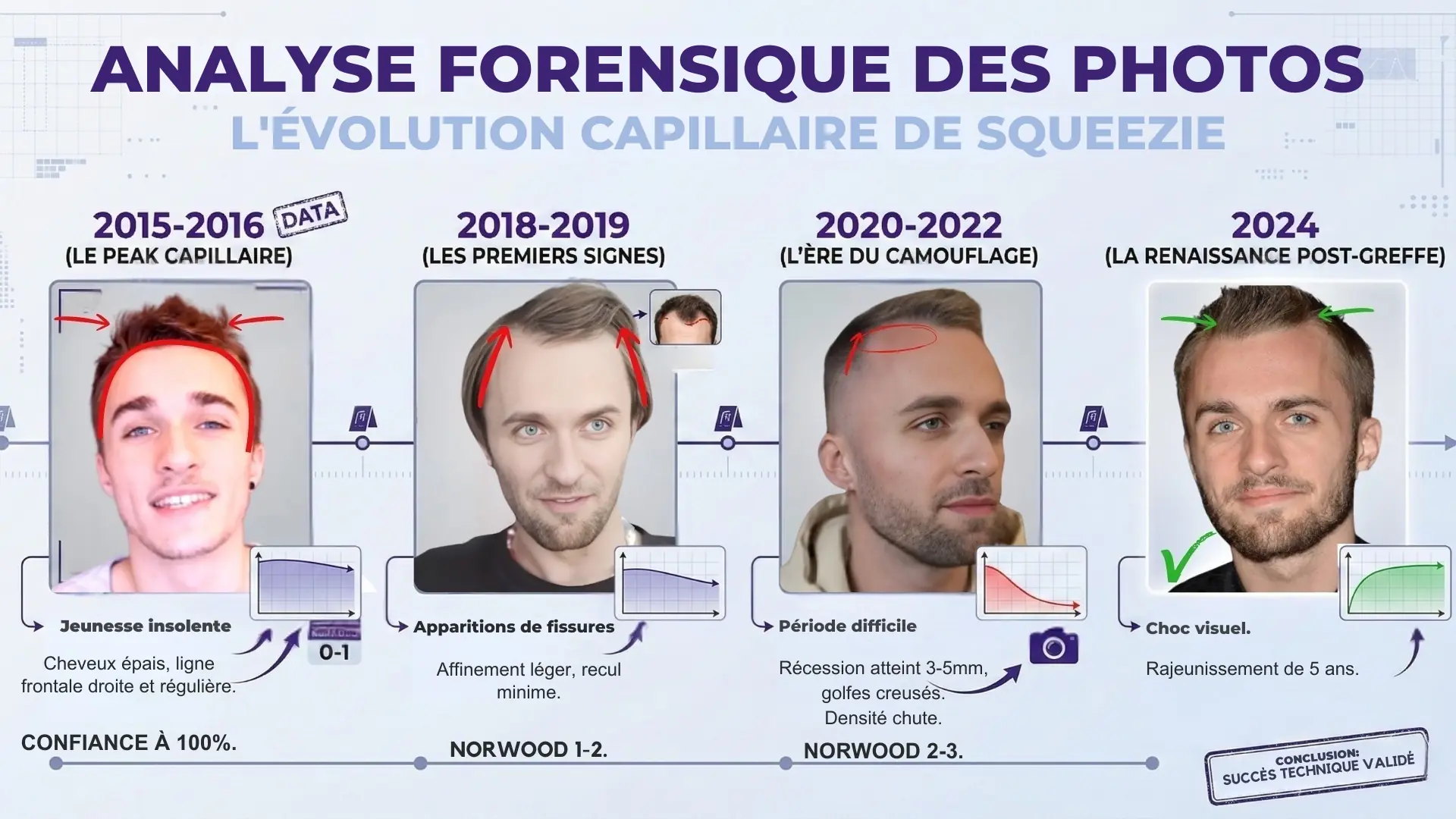 Étude détaillée de quatre photos de Squeezie (2015-2024) avec graphiques montrant le recul progressif des golfes puis la restauration.