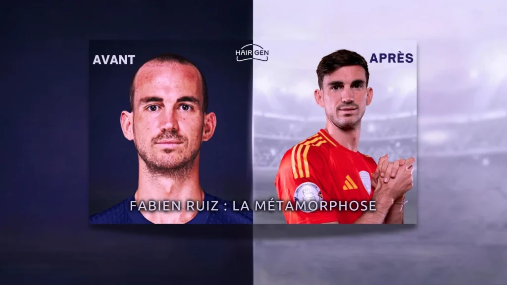Image scindée en deux : à gauche, un gros plan sur le visage marqué et dégarni de Ruiz ; à droite, le joueur avec une chevelure dense sous le maillot espagnol.