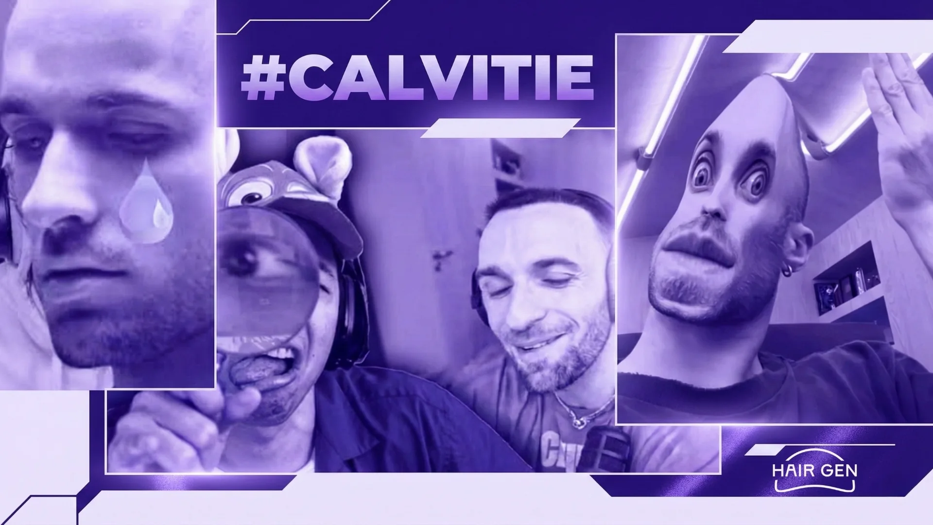 Montage humoristique violet avec le hashtag #CALVITIE montrant Squeezie pleurant ou déformé par des filtres drôles.