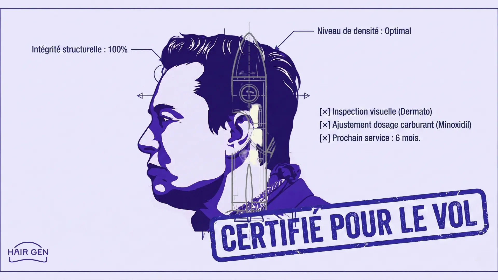 Illustration humoristique superposant un plan de fusée au profil de Musk, traitant sa maintenance capillaire (Minoxidil, densité) comme une checklist aérospatiale.