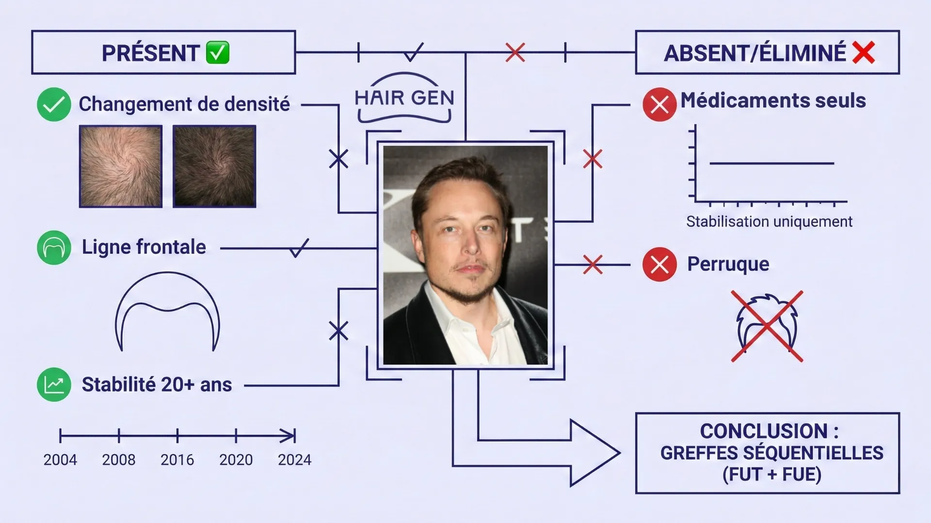 Diagramme d'analyse capillaire éliminant les hypothèses de la perruque ou des médicaments seuls, pour conclure logiquement à une combinaison de greffes FUT et FUE.