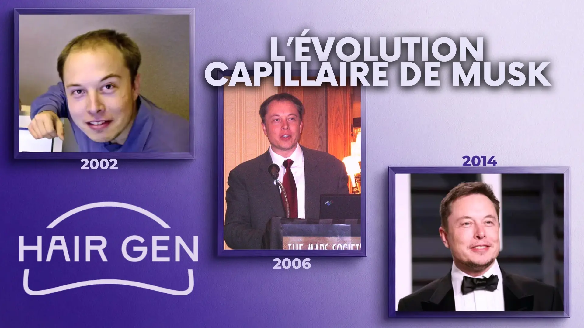 Montage chronologique comparant trois stades : la calvitie visible en 2002, une amélioration en 2006, et le résultat dense en 2014.