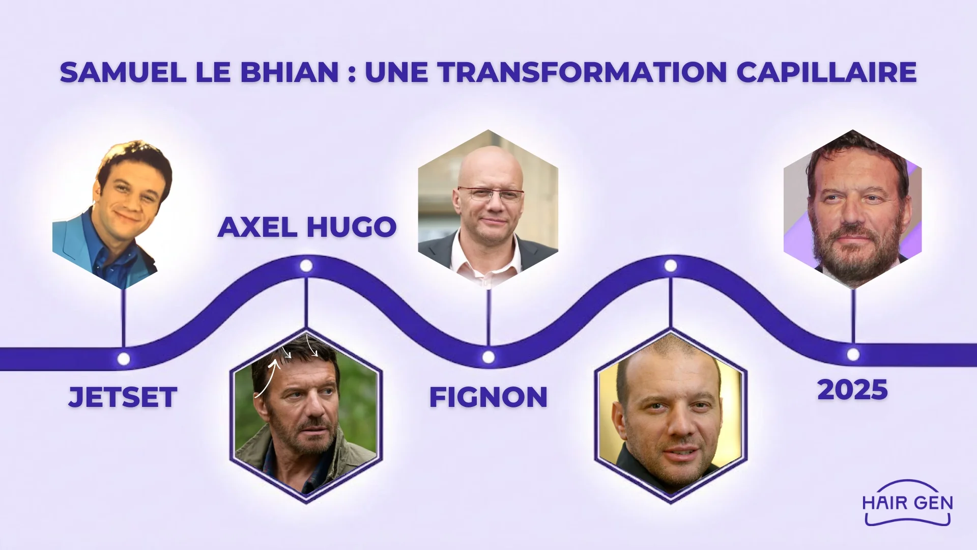 Frise chronologique Hair Gen traçant l'évolution capillaire de Samuel Le Bihan, de ses débuts Jetset à son look stabilisé en 2025.