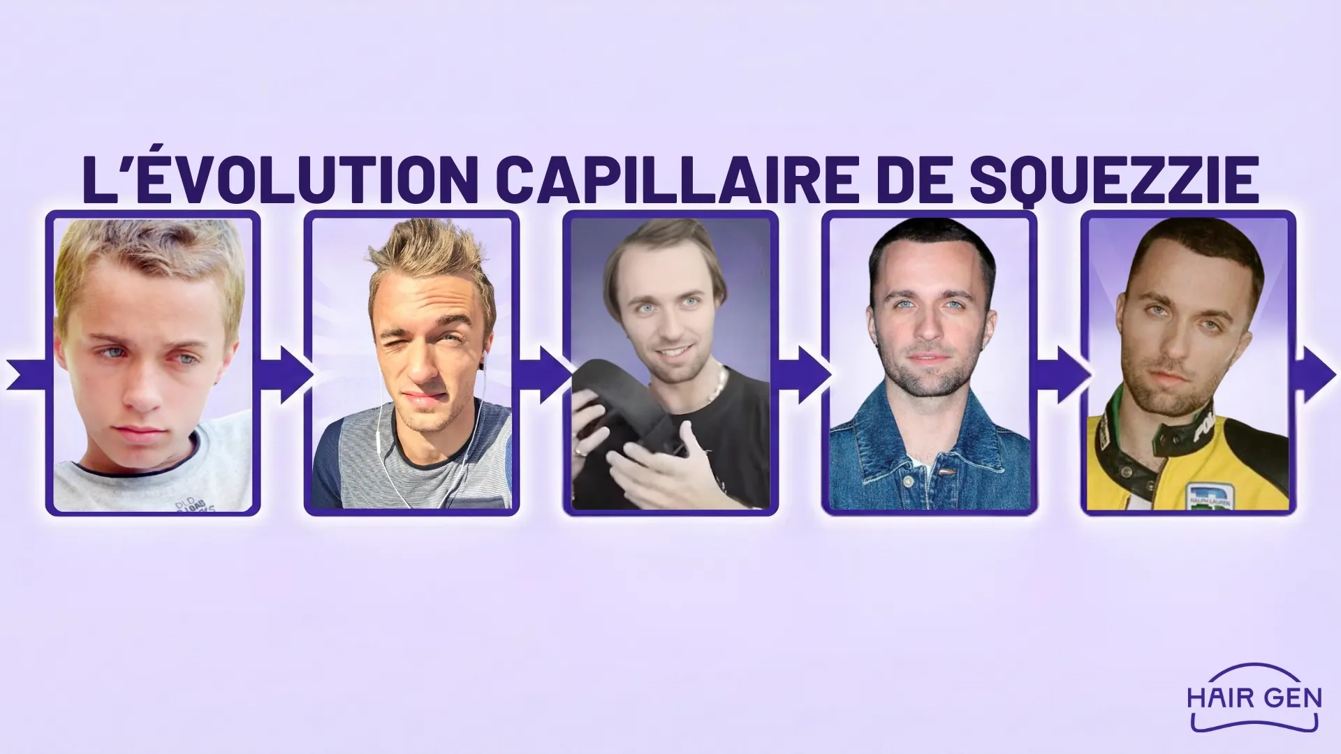 Série de 5 portraits chronologiques de Squeezie, montrant son passage de l'adolescence à l'âge adulte avec sa nouvelle densité capillaire.