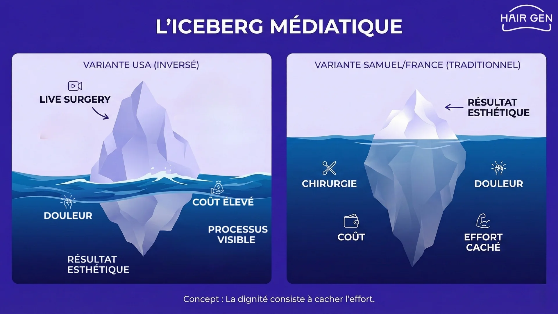 Schéma comparant deux icebergs : la variante USA où le processus est visible, et la variante française où chirurgie, douleur et coût restent cachés sous la surface.