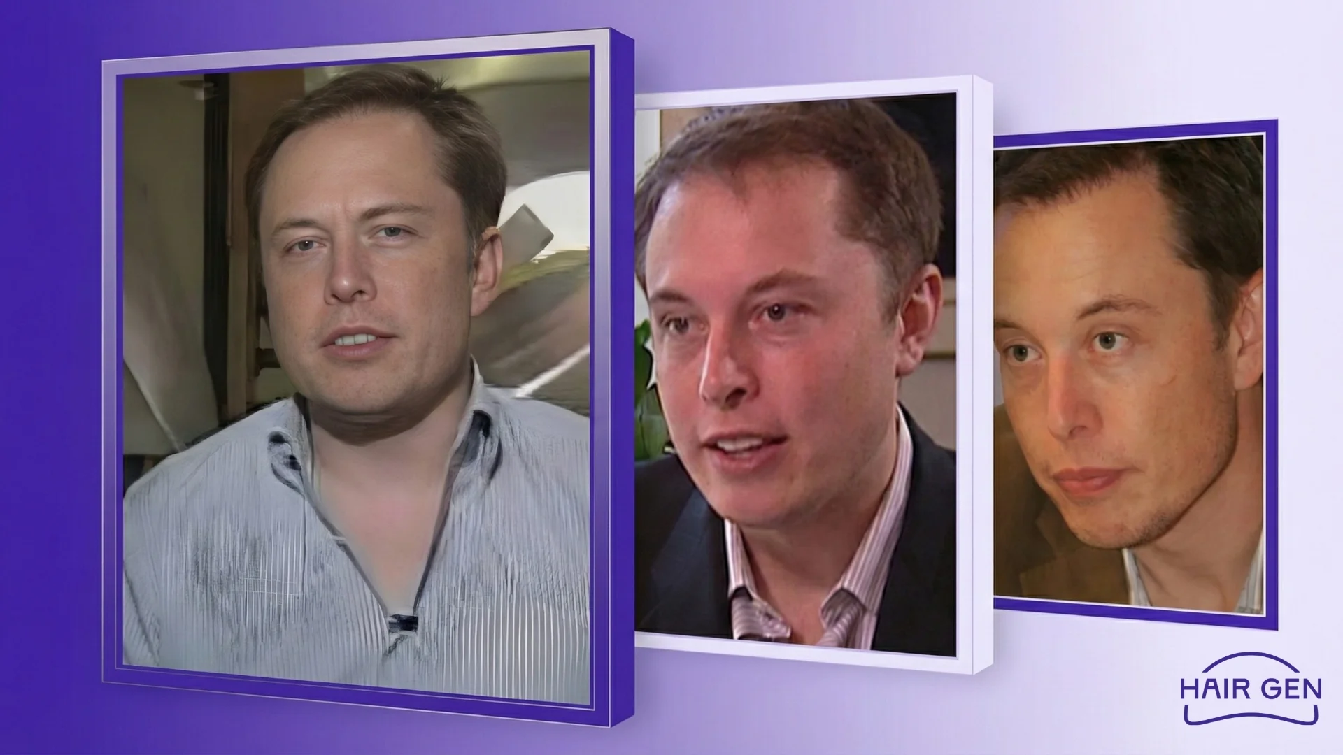 Elon Musk début Tesla avec cheveux restaurés