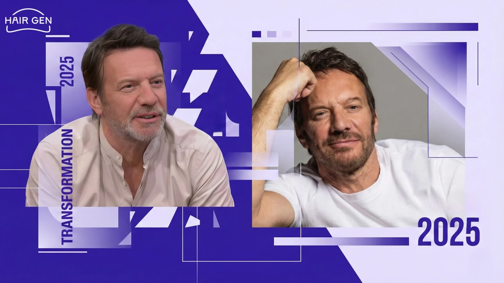 Portraits récents de Samuel Le Bihan en 2025, affichant une ligne frontale naturelle et une densité adaptée à son âge.