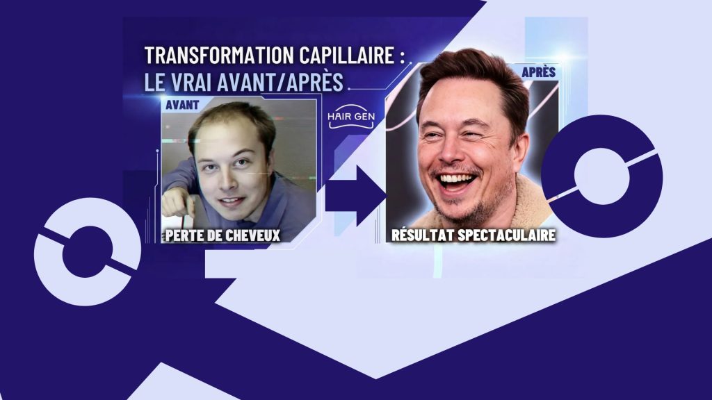 Comparaison directe en écran scindé : à gauche Elon Musk dégarni ("Perte de cheveux") et à droite souriant avec des cheveux denses après sa greffe de cheveux.("Résultat spectaculaire").