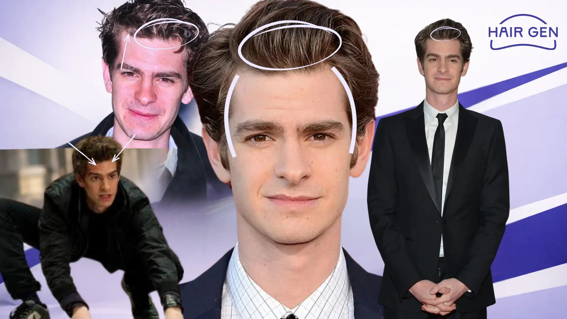 Analyse de la ligne frontale d'Andrew Garfield et indices de greffe capillaire.