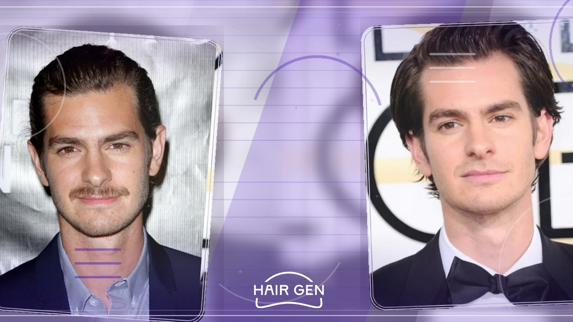 Andrew Garfield avec les cheveux plaqués en arrière, exposant une récession évidente des golfes temporaux.