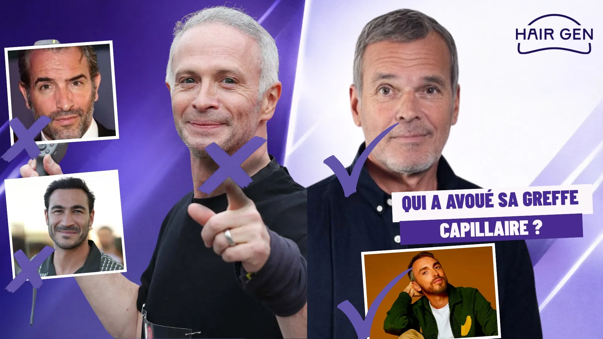 Comparaison des célébrités françaises assumant ou non leur restauration capillaire.