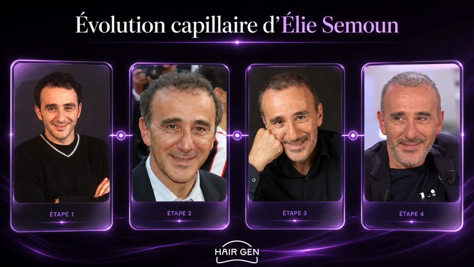Frise évolution capillaire Élie Semoun avant après cheveux clairsemés densité retrouvée