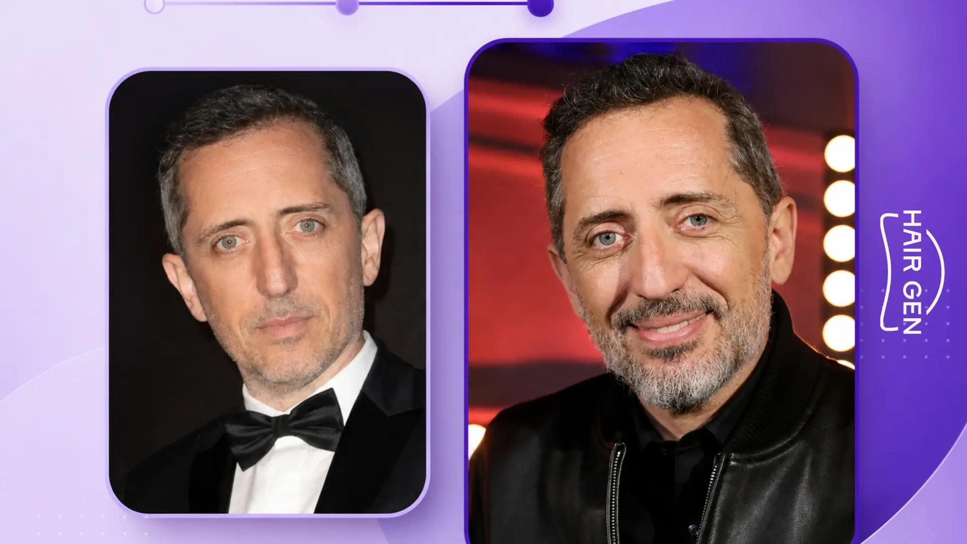 Gad Elmaleh cheveux bruns image maîtrisée implants capillaires