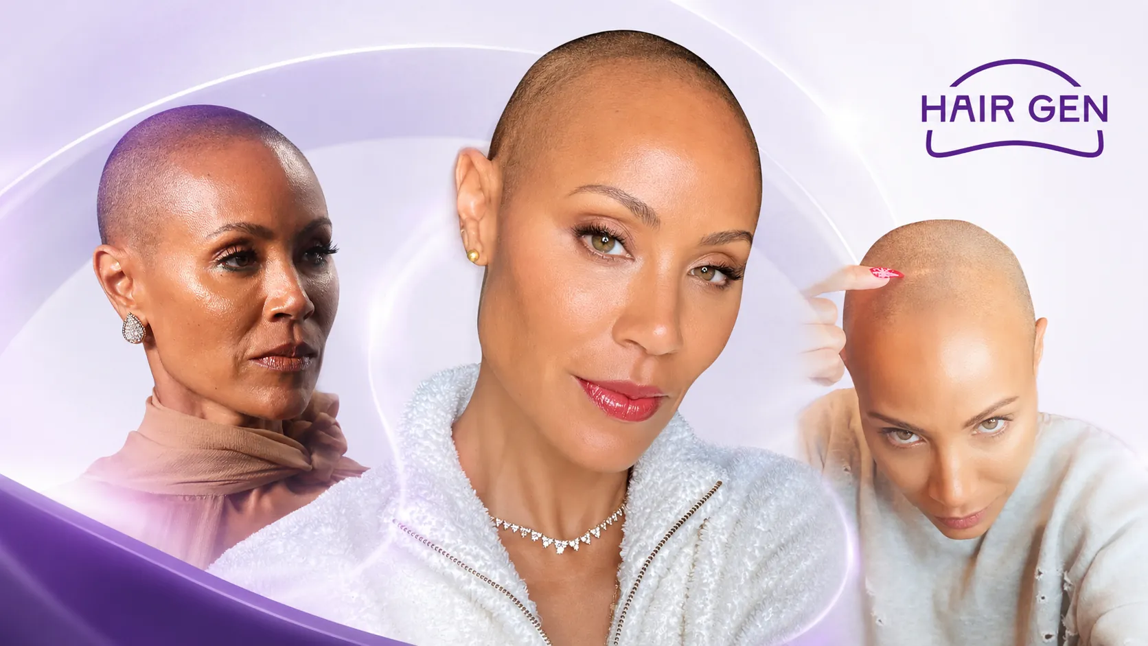 Illustration éditoriale autour de Jada Pinkett Smith et de l’alopécie féminine